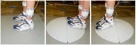 The eQ Almond appears to have an influence on modifying muscle co-activation levels during standing. The pain group responded to standing on the eQ Almond by showing a marked decrease in the co-activation of the bilateral gluteus medius muscles.